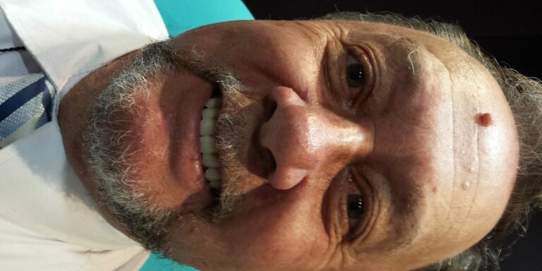 +get +false +teeth, +cost of +dentures, +denture +repair +auckland, +dentures +auckland, Allergy free Denture, Thermosens, Unbreakable Denture, Flexible Denture, Auckland Dentures, New Dentures, New Smile, Get Dentures, Papatoetoe Dentures, Manukau Dentures, South Auckland Dentures, Denture Repairs, Fix Broken Dentures, Denture Reline, Mangere Dentures, Otahuhu Dentures, Dentist, Fix Teeth, Fix Denture, Best Denture, Dentures Auckland, Dentures, Denture teeth, Partial Denture, new front tooth, new front teeth, Dental Crowns, Dental polish, Dental Clean, Dentist Clean, Dental Implants, Comfortable Denture, Guarantee Denture, Warranty Denture, Otara Denture, Onehunga Denture, Onehunga Dentist, Smile Dental, Hillpark Dental, Papakura Dentist, Papakura Dentures, Denture Repairs, Denture Relines, Best Dentures, Quality Dentures, Designer Dentures, New Smile, WINZ Denture, Pension Dentures, Insurance Dentures, AMI Dentures, State Insurance Dentures, IAG Dentures, Affordable Dentures, Low Cost Dentures, Cheap Dentures,